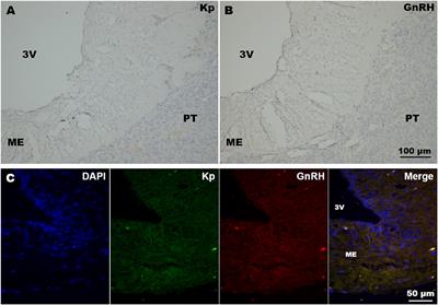 Distribution of GnRH and <mark class="highlighted">Kisspeptin</mark> Immunoreactivity in the Female Llama Hypothalamus